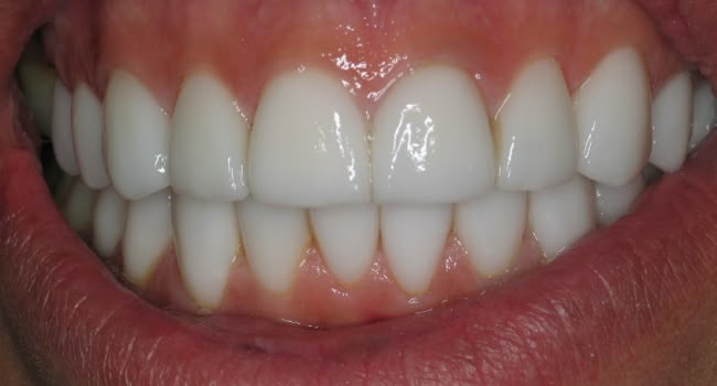 A bright, healthy smile with straight white teeth and pink gums.