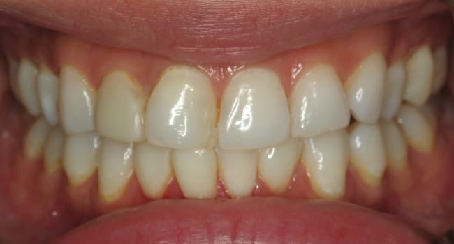 A smile with teeth problems