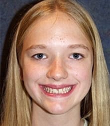 Bright young woman with a friendly smile with spacing issues