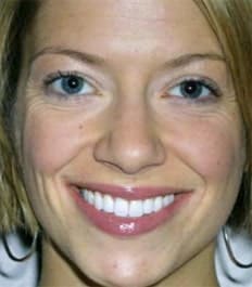 Bright smiling woman with perfect teeth