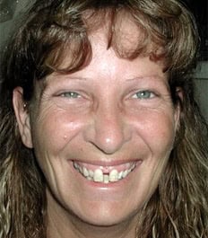 Smiling woman with teeth spacing issues, close-up portrait.